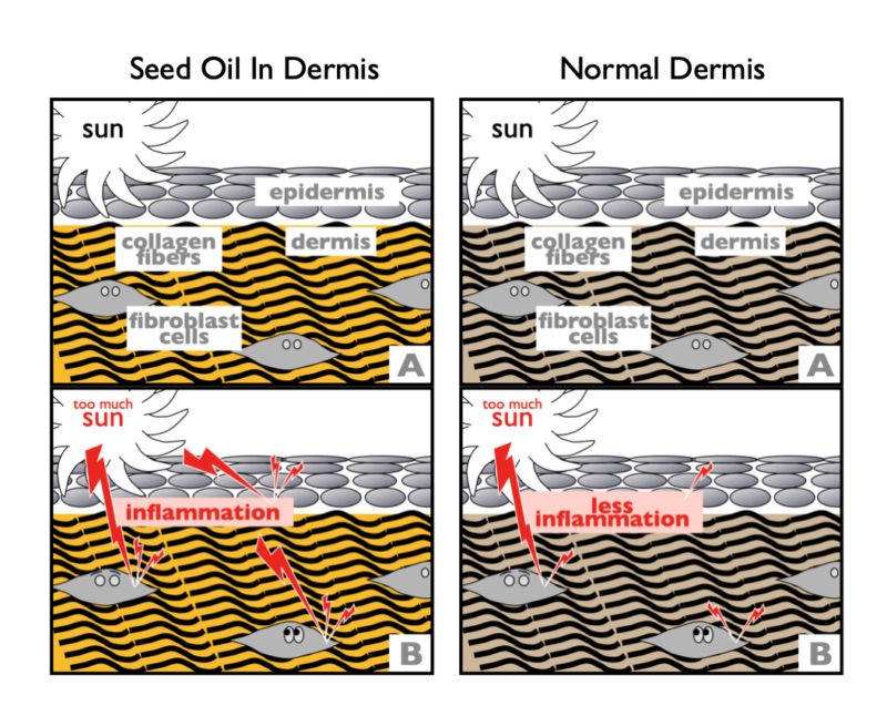 seed-oil-sunburn