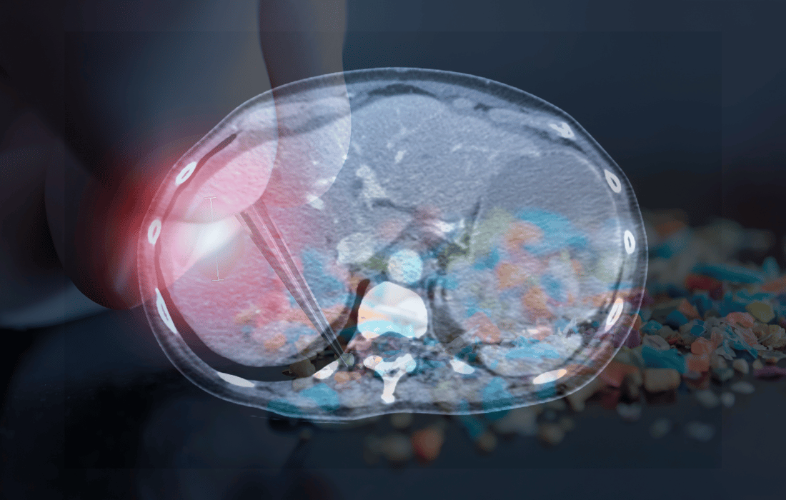 microplastics-organ-lesions